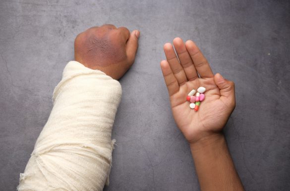 Zwei Arme, einer bandagiert, der andere hält bunte Pillen in der Hand.